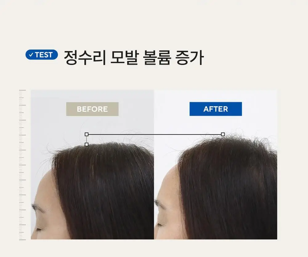 [두피쿨링/탈모증상완화] 아로마티카 티트리 퓨리파잉 토닉 100ml (단품/더블기획) 상세페이지 14